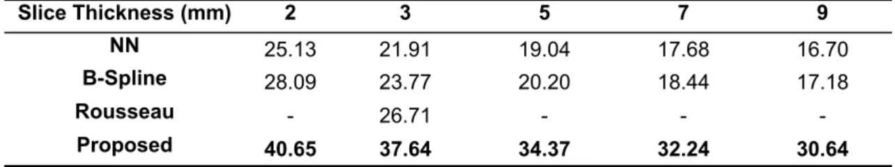 Table 1.   PSNR values (larger  values  are better) of the different methods  compared for several  slices thicknesses for the normal brain anatomy case.