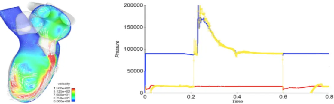 Figure 1: Typical computed results in the realistic full heart model. On the left: 2D cut of the velocity field in cm/s during ventricle’s filling