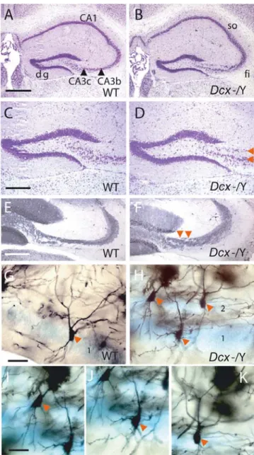 Figure 1. Morphological Abnormalities in the Dcx KO Hippo- Hippo-campus. (A–D) Cresyl violet staining showed that dentate gyri were indistinguishable between the genotypes, however, abnormally  orga-nized CA3 pyramidal cells in the KO hippocampus were obse