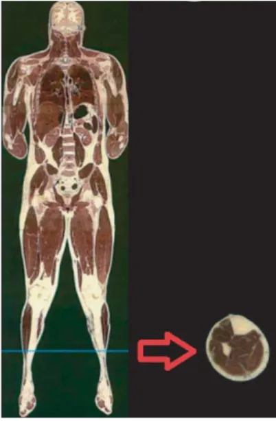 Figure 1. Tomographic image of a human ankle. Figure 2. 2D and 3D of the human ankle HFSS model (units: mm).