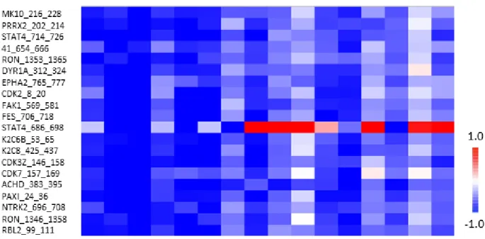 Figure 4: Relationship between ex vivo  sunitinib-related  inhibition  profiles  in  PBMC  from  metastatic  renal  cell  carcinoma patients and lymphocytes ratio D21/D0 (n = 16)