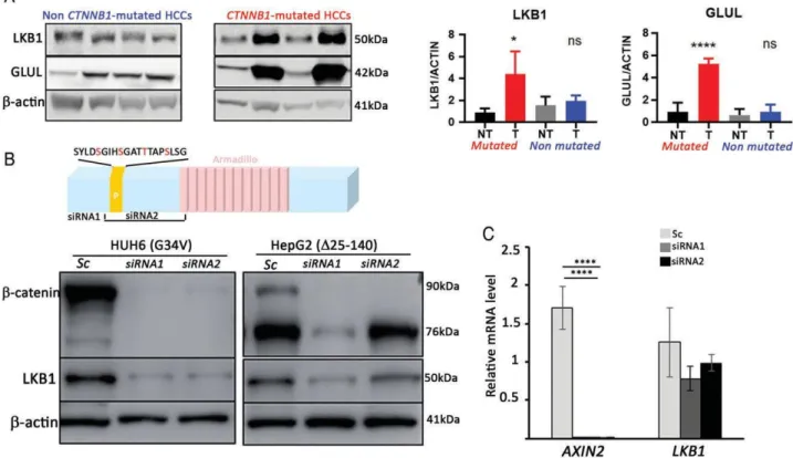 Figure  1.  Oncogenic β-catenin drives LKB1 protein expression. (A) LKB1 accumulates in a large subset of  CTNNB1 -mutated HCCs