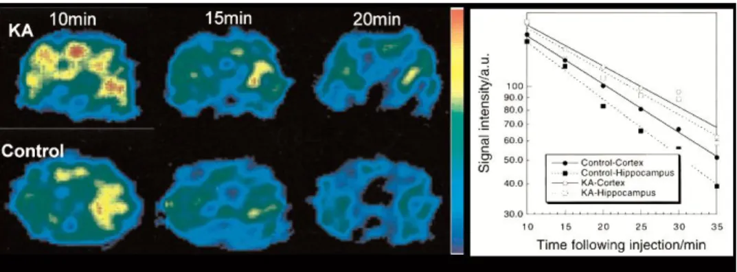 Fig. 6. EPRI of rat brain. Left. The dynamic pattern of  selected transversal EPR images of  rat head 5 mm posterior to the bregma in the KA-treated and control groups at different  times following injection of PCAM nitroxide