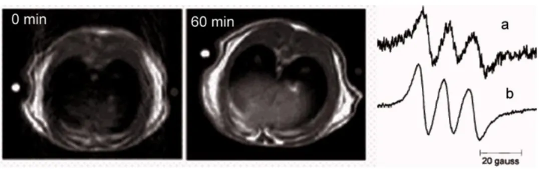 Fig. 9. LPS treated rats. Left: T1W MRI images of the rat abdomen prior to and after injec- injec-tion of the NO spin trap
