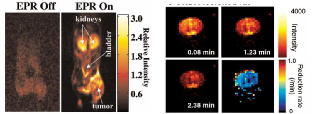 Fig. 10. Left. Interleaved (‘‘EPR off’’ and ‘‘EPR on’’) OMRI images (coronal) of bearing  SCC tumor on the right hind leg, demonstrating the Overhauser enhancement (OE) and  the diagnostic quality achievable at this low magnetic field of 15 mT