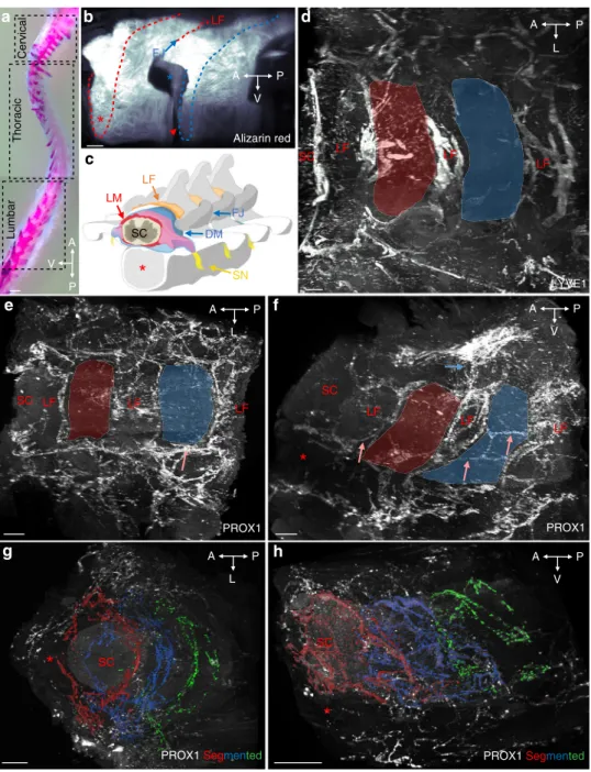 Fig. 1 Segmental pattern of the vertebral lymphatic vasculature in the thoracic spine