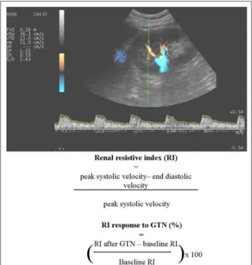 FIGURE 3 | An example of renal Doppler sonography. A number of variables expressing flow pulsatility and vascular resistance can be determined, including renal resistive index (RI) and dynamic RI.