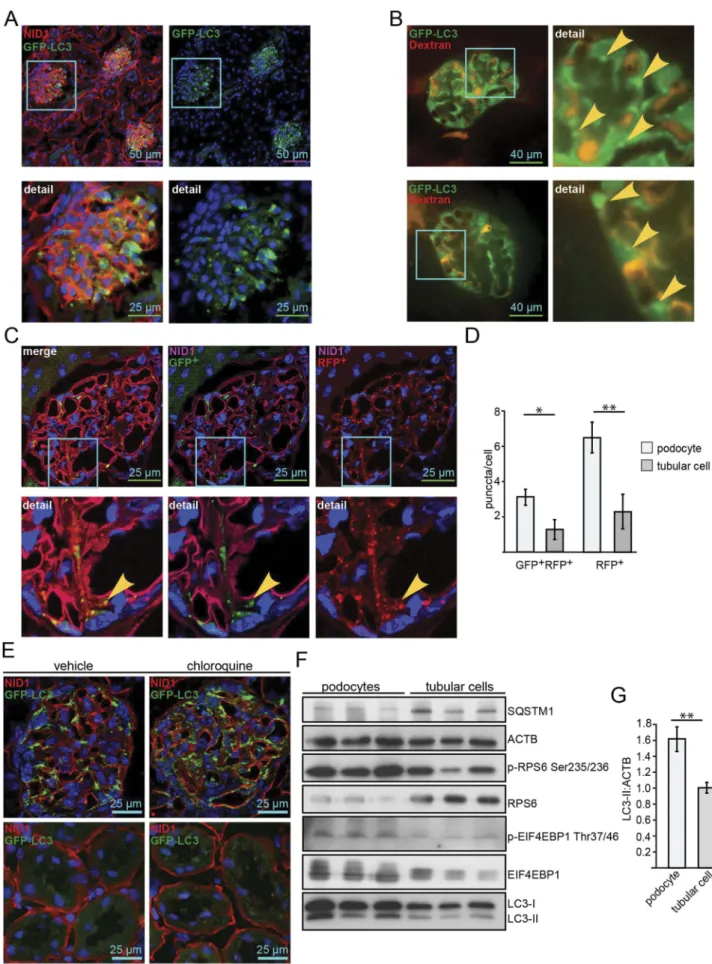 Figure 1. Podocytes exhibit high levels of basal autophagy and autophagic flux. (A) Representative images obtained from cryosections of 4-month old Gfp-Lc3 mice stained for the basement membrane marker NID1/nidogen-1/entactin (red) and GFP-LC3 (green)