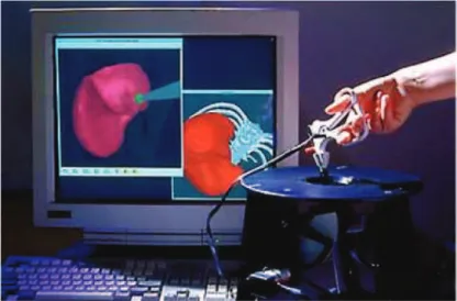 Fig. 2.5 – Simulation de chirurgie de laparoscopie en 1999 [Cotin et al., 1999].