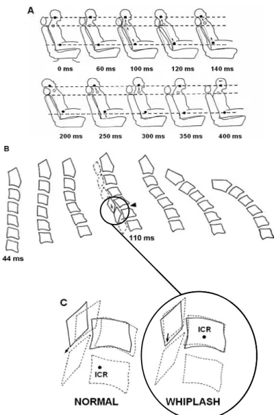 Fig. 18 Schéma représentant le mécanisme lésionnel lors d’un whiplash à différentes échelles