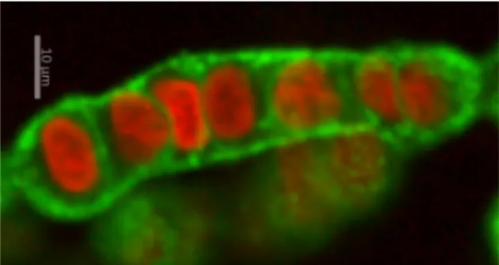 FIG. 6. Cell shapes during spheroid fusion show collective cell alignments and disordered behavior