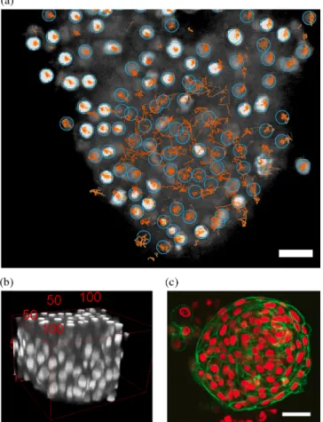 FIG. 1. Live cell tracking in primary human tumor explants shows regions of high and low cell motility
