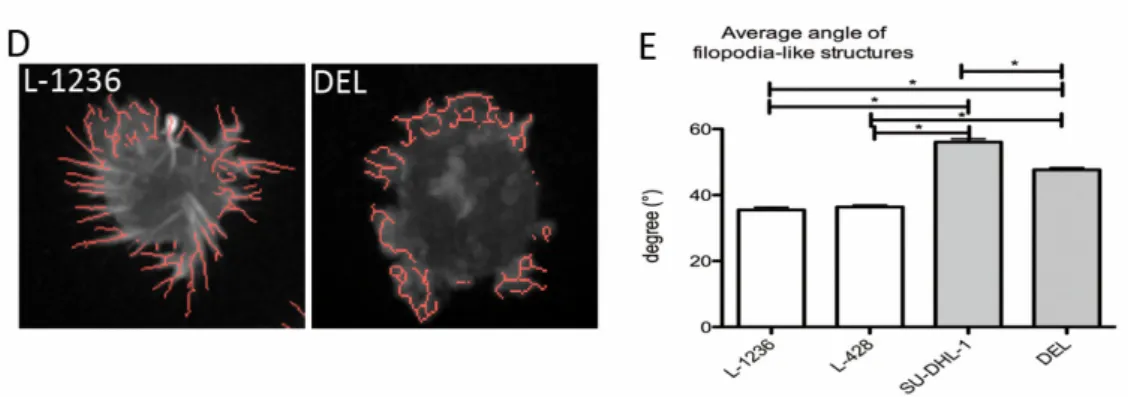 Figure 4. Filopodia-like structures are more frequent, longer and have a more orthogonal orientation in cHL cell lines L-1236 and L-428 compared with ALCL cell lines DEL and SU-DHL-1, which are embedded in a collagen gel