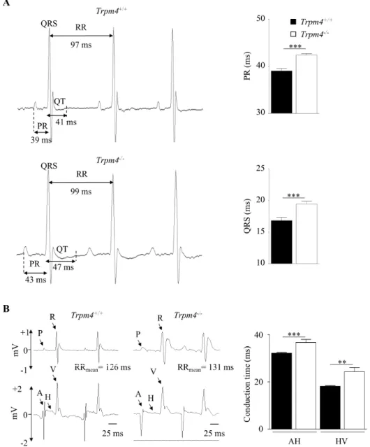 Fig. 3. Electrocardiograms (ECGs) and intracardiac conduction analyses in Trpm4 +/+ and Trpm4 -/- -/-mice