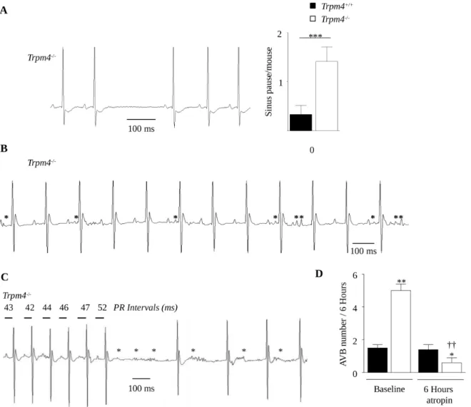 Fig. 4. Abnormal electrical activity in Trpm4 -/- mice. Arrhythmic events were counted during 12h nocturnal periods according to the Lambeth convention (A) Typical sinoatrial node (SAN) pause