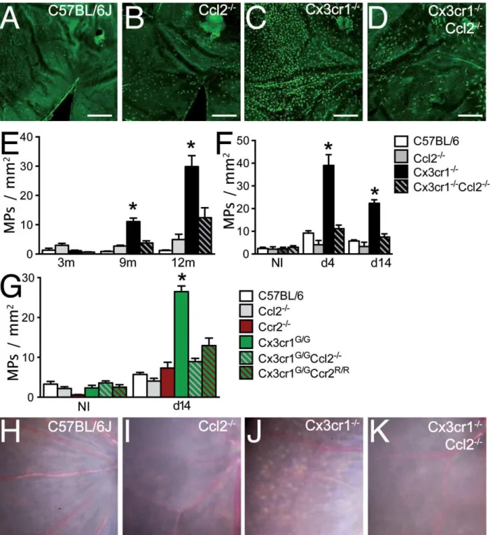 Figure 3. CCL2 mediates subretinal MP accumulation in age and light‐challenged Cx3cr1 / mice.