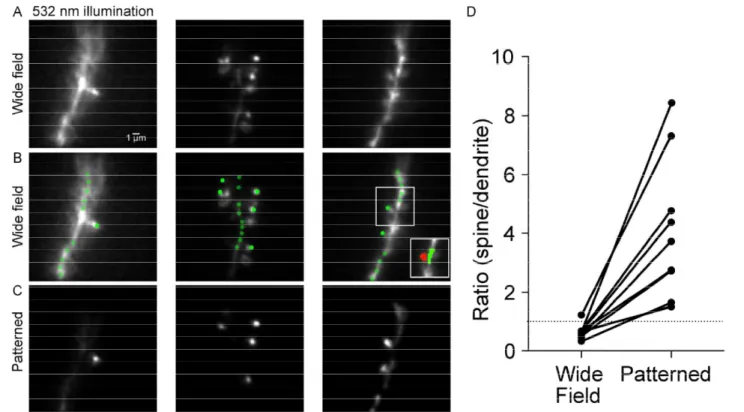Figure 3. Contrast improvement with intensity gradient holographic illumination. A) Fluorescence  images of small sections of basal dendrites from three L5 pyramidal neurons under wide-field 