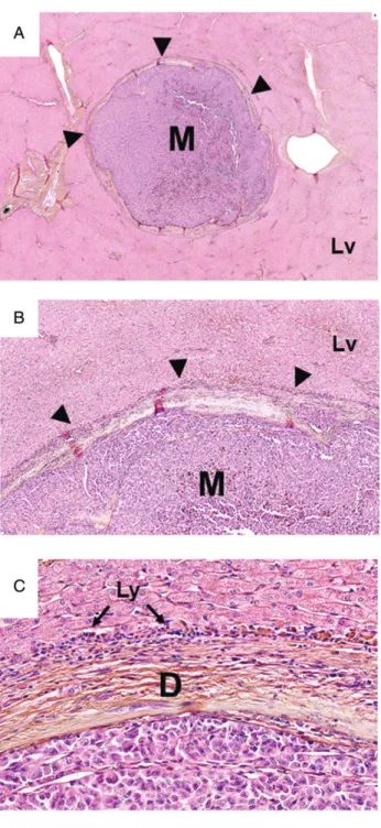 Figure 3. Desmoplastic histopathological growth pattern.