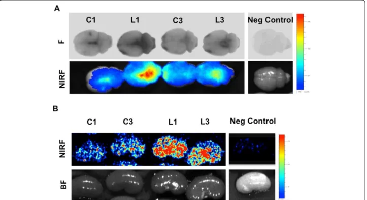 Figure 3 Blood – cerebrospinal fluid barrier and glomerular barrier permeability to Evans blue dye
