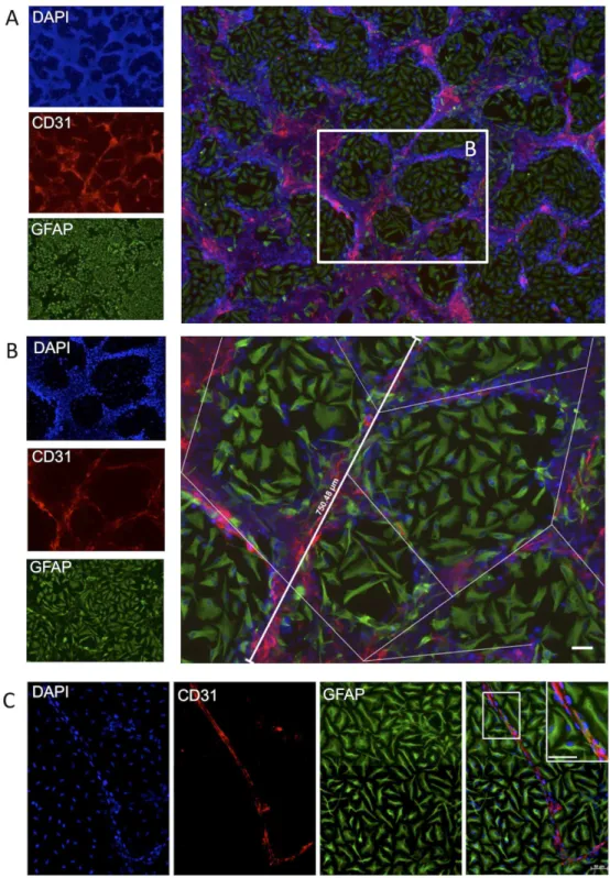 Figure 3. Immunohistochemistry of junctional markers on endothelial cells. Localization of ZO1 expression/detection was heterogeneous, with it being only visible as part of the membrane (i.e