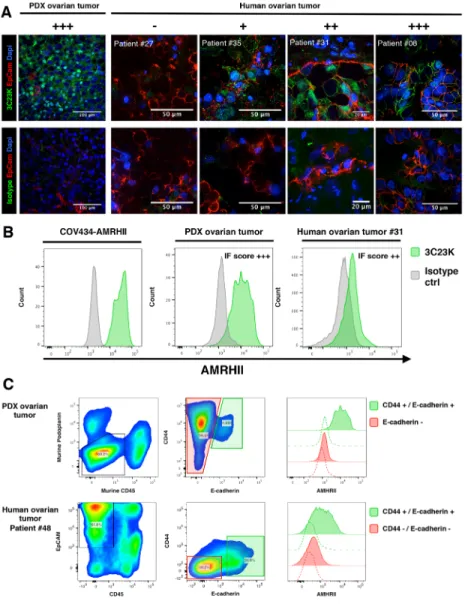 Figure 1: Immunofluorecence determination of AMHRII expression: AMHRII is heterogeneously expressed in human  ovarian cancers and stained by the glycoengineered anti-human AMHRII humanized mAb 3C23K