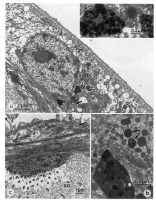 Figure II.4 :  B. seepensis.  a  Lysosome  composé  (ly),  entouré  de  citernes  de  reticulum endoplasmique  rugueux  (flèche)  et  de  l'appareil  de  Golgi  (g)