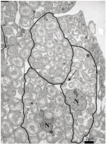 Figure 6 : Section transversale d’un lobule de trophosome vue en microscopie électronique (Cliché :  A