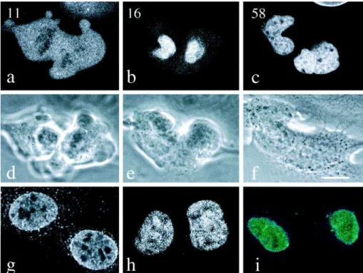 Figure 16  : Séries d’images confocales (a -c) et des contrastes correspondants (d-f) de cellules  PAM vivantes exprimant la GFP-lamine A, de la fin de la télophase au début de la phase G1  (Moir et al., 2000)