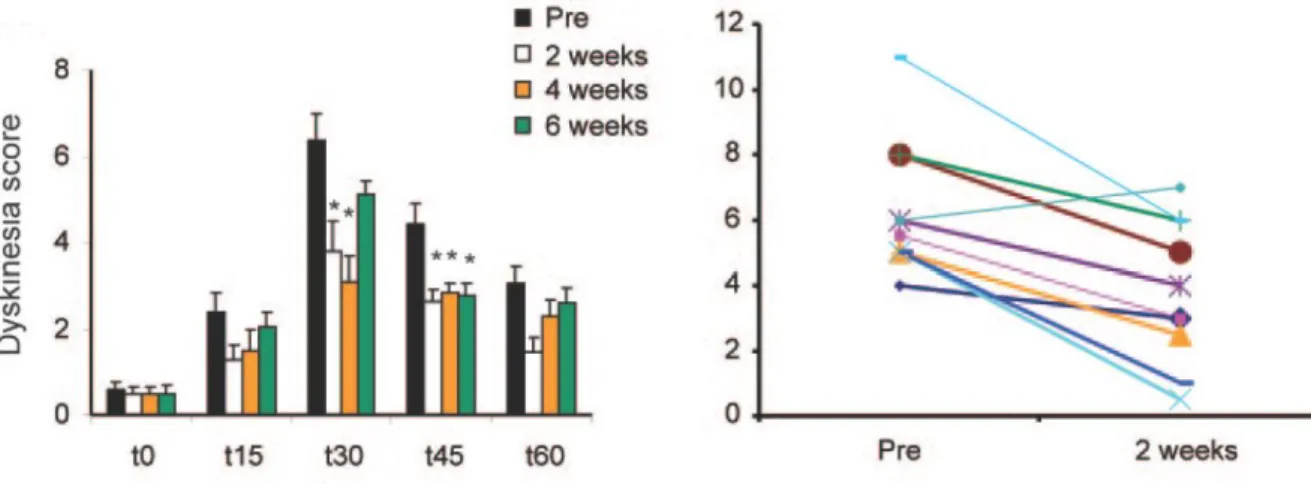 Figure 9  Effet  anti-dyskinétique  des  stimulations  cTBS  des  hémisphères  cérébelleux  chez  le  patient  parkinsonien