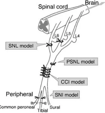 Figure 8 | Diagramme des différents modèles neuropathiques de lésion physique du nerf  sciatique (d’après Ueda, 2006)