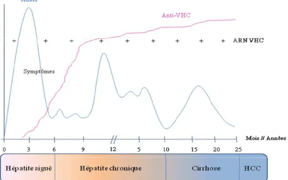 Figure 3 : Profil d une hépatite C évoluant vers la chronicité. D après Zoulim ; Reviews  in Medical Virology (Zoulim et al