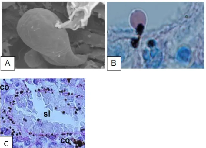 Figure  1-17.  Illustration  du  processus  de  pitting.  (A)  Déformation  d’un  globule  rouge  lors  de  son  passage dans une fente interendothéliale de la pulpe rouge splénique (microscopie électronique à  balayage)