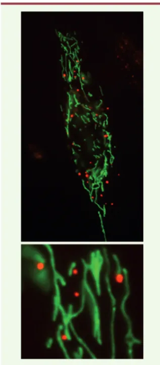 Figure 1.  Interaction préférentielle des  P-bodies (rouge) avec les mitochondries (vert)  dans des cellules d’épithélium pigmentaire  de rétine humaine (RPE-1)