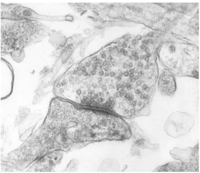Figure 1.3 Microphotographie électronique d’une synapse issue d’une culture de neurones du rat