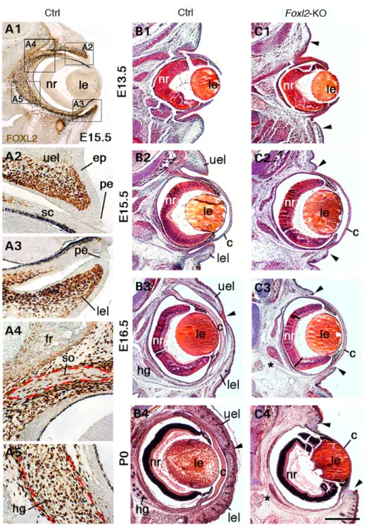 Figure 2. Foetal distribution of FOXL2 in the periocular region and eyelid developmental defect in Foxl2-KO mice