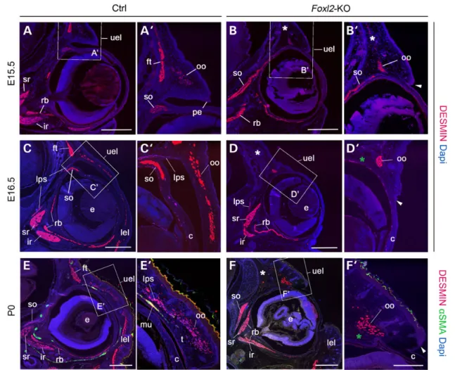 Figure 3. Defect of extraocular muscle development in Foxl2-KO foetuses. (A–D, A′–D′) Immunoﬂuorescent detection of the myogenic marker DESMIN (E and F, E′and F′) and co-immunoﬂuorescent localization of DESMIN and αSMA on frontal sections in the periocular
