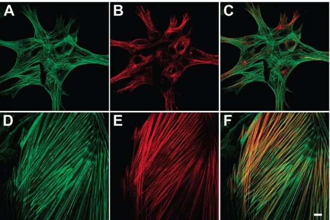 Figure  11.  Localization  of  total  actin  and  smooth  muscle  R-actin  in  A7r5  cells  cultured  on  native  and  cross-linked  (PAA/PAH)  films