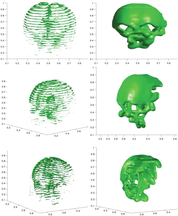 Figure 4.12. Trois diﬀérentes vues d’une reconstruction d’un cerveau à partir de coupes d’une image obtenue par IRM.