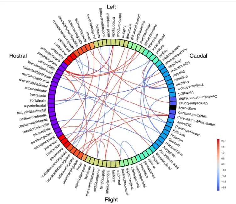 FIGURE 4 | White matter connectivity differences between groups. Red = people with fluent speech (PFS) > people who stutter (PWS)