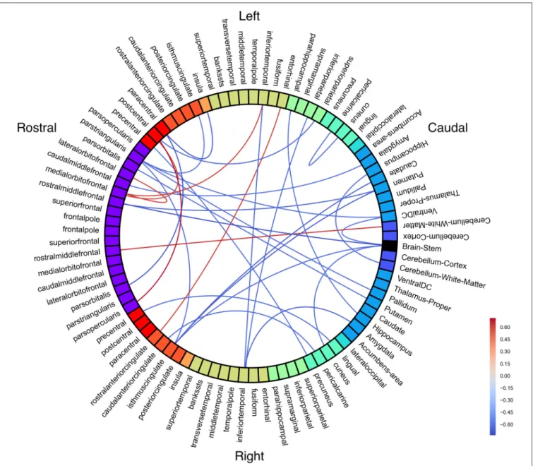 FIGURE 5 | White matter connectivity correlated with Stuttering Severity Instrument 4 (SSI-4) in people who stutter (PWS)