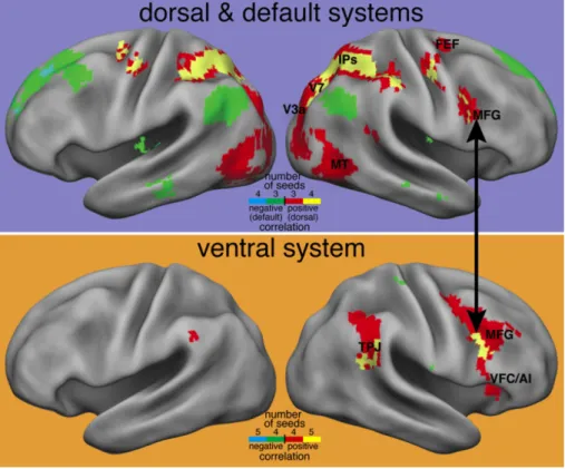 Figure 2.16 – R´ eorientation de l’Attention selon Corbetta et al. — (haut) L’attention port´ee sur un objet fait appel aux r´egions frontopari´etales dorsales et d´esactive les r´egions ventrales ; (bas) Si un ´ev´enement inattendu et important n´ecessite
