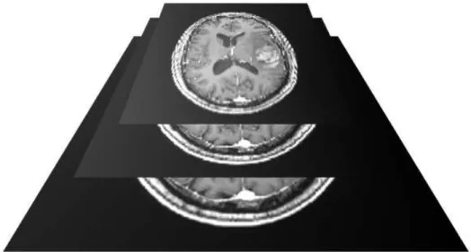 Figure 2.7: 3 niveaux de résolution de la même image, de la plus grossière à la plus ne en partant de haut