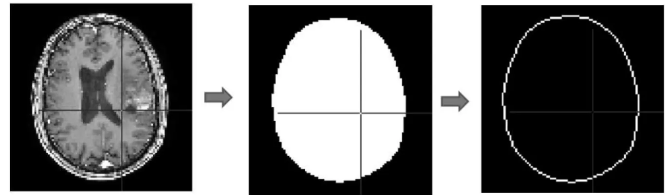 Figure 4.5: Proessus d'extration du ontour du râne sur les images IRM. De gauhe à droite les étapes sont