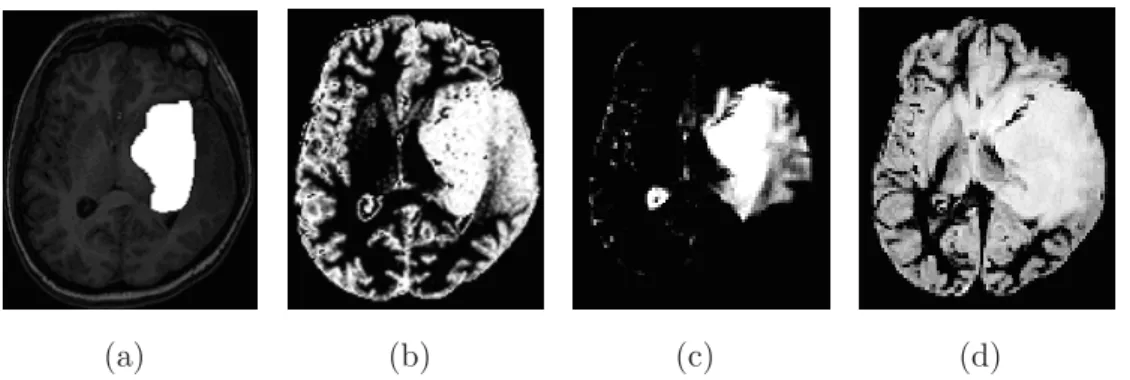 Fig. 2.11 – La r´ egion r´ ef´ erence R et les ensembles ﬂous de caract´ eristiques de R