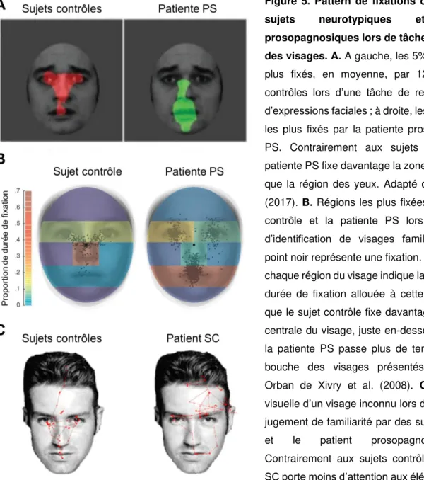 Figure  5.  Pattern  de  fixations  oculaires  des  sujets  neurotypiques  et  patients  prosopagnosiques lors de tâches impliquant  des visages