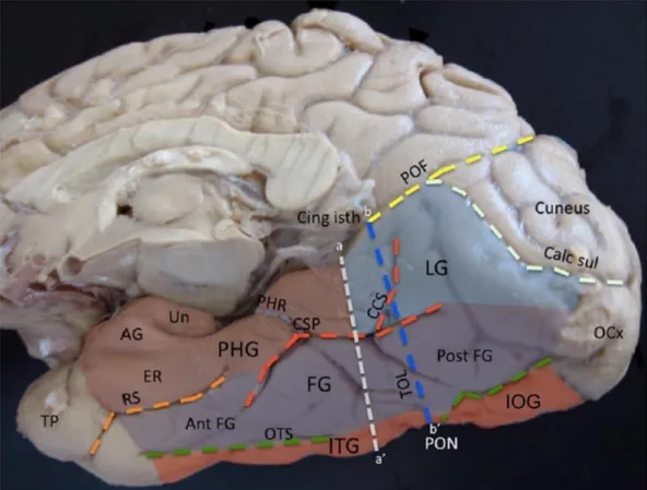 Figure 6. Représentation anatomique des régions du VOTC. Vue inféro-médiale des lobes occipital et  temporal droits