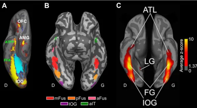 Figure  11.  Activation  en  neuroimagerie  fonctionnelle  des  régions  sélectives  aux  visages  dans  le  VOTC