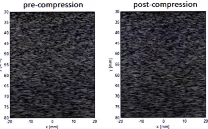 Figure 2-3  The  simulated pre-compression  and  post-compression  B-mode images.