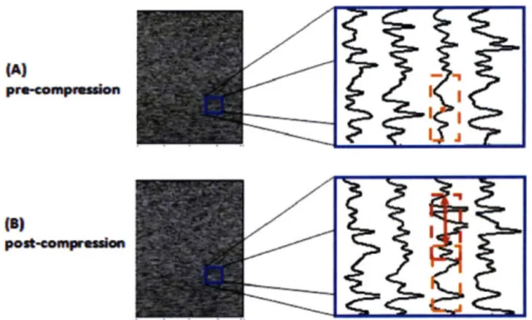 Figure  3-5  Displacement  estimation  is  performed  based  on  a  template-matching scheme using  the waveforms  inherent  in the ultrasound images