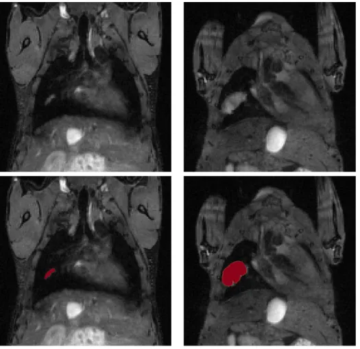 Figure 5.17: Top: Coronal MRI data of the lungs at days 19 and 26. Bottom: simulated growth by the model using the fitted parameters and starting from the real shape of the observed metastasis at day 19 on the coronal MRI slice.